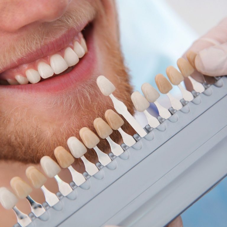 estetica-dental